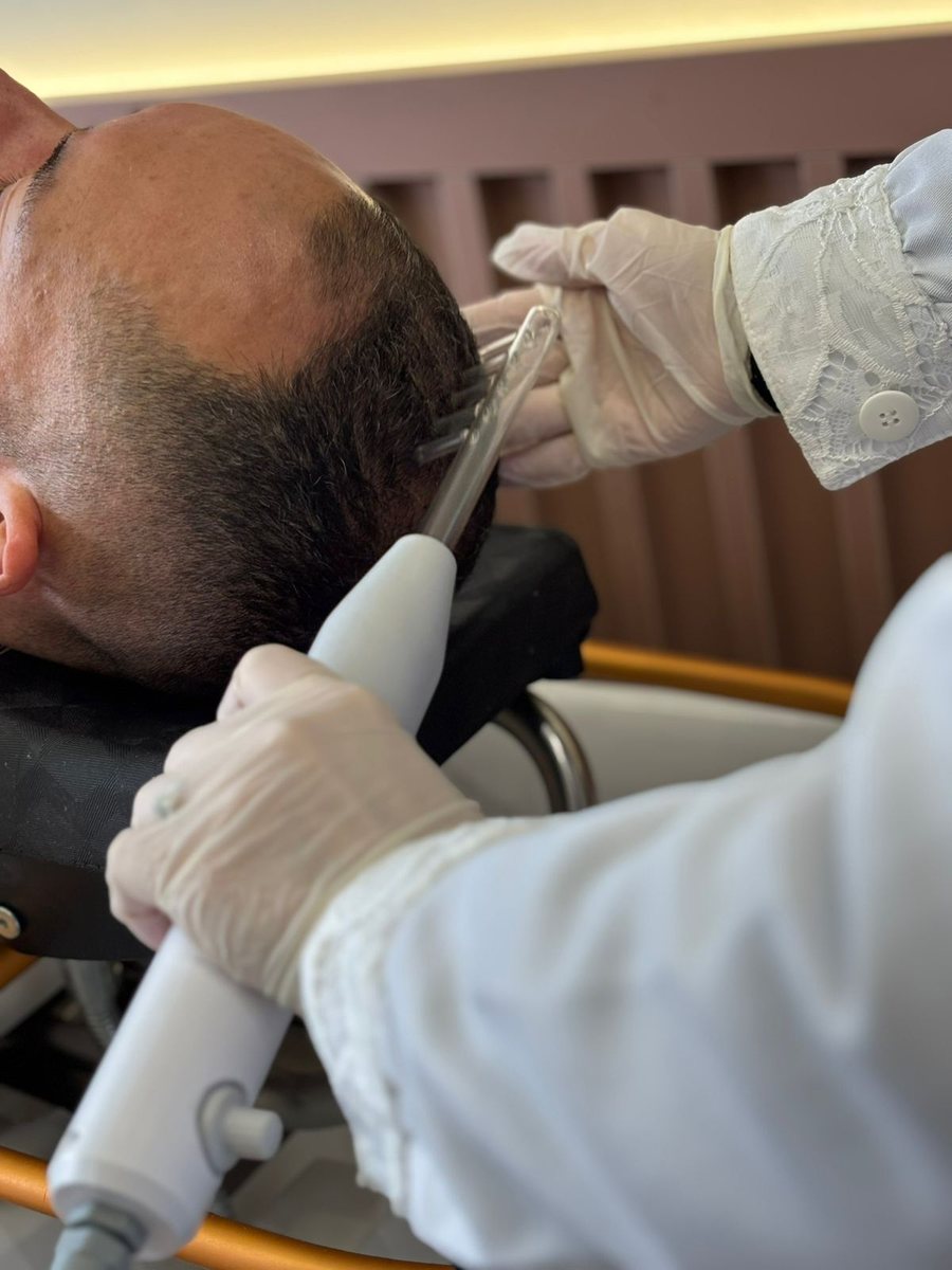 Terapia Capilar